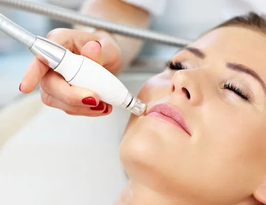 Épilation de la lèvre avec laser chez Dermapure