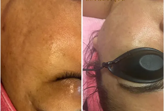 Réduction sur soin du visage avec coupon rabais